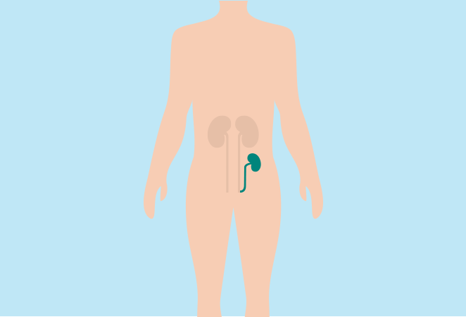 7. BAXTER_DTP_ContentPage_HD_in_What is a kidney transplant.png