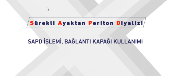 SAPD işlemi, bağlantı kapağı kullanımı