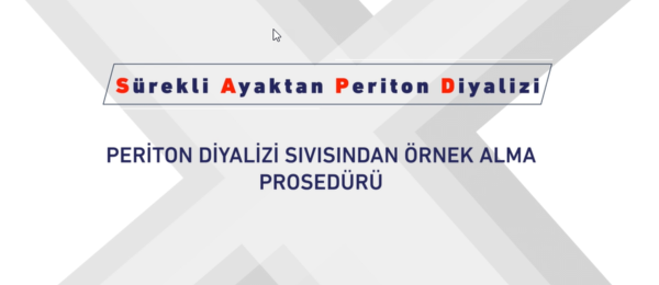 SAPD işlemi, periton diyalizi sıvısından örnek alma prosedürü