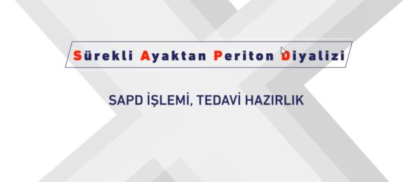 SAPD işlemi, tedavi hazırlık